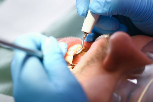 Best Pediatric Emergency Dentist in Valley Center, CA
