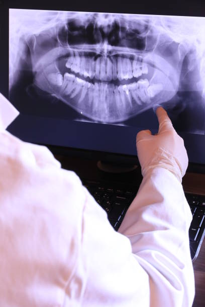 Best Broken or Cracked Tooth Emergency Dentist in Valley Center, CA