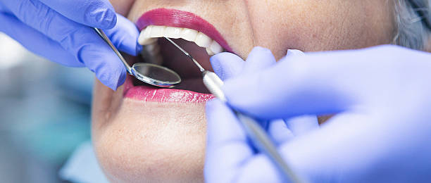 Best Broken or Cracked Tooth Emergency Dentist in Valley Center, CA